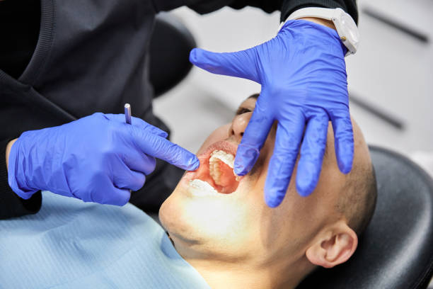 Best Emergency Tooth Extraction in White Rock, NM